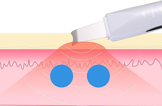 Face Blackhead Remover - Elvoque