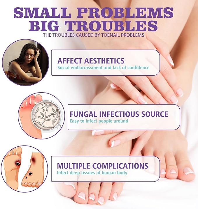 Nail Fungus Spray - Elvoque