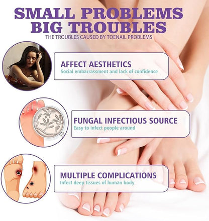 Nail Fungus Spray - Elvoque