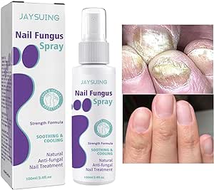 Nail Fungus Spray - Elvoque