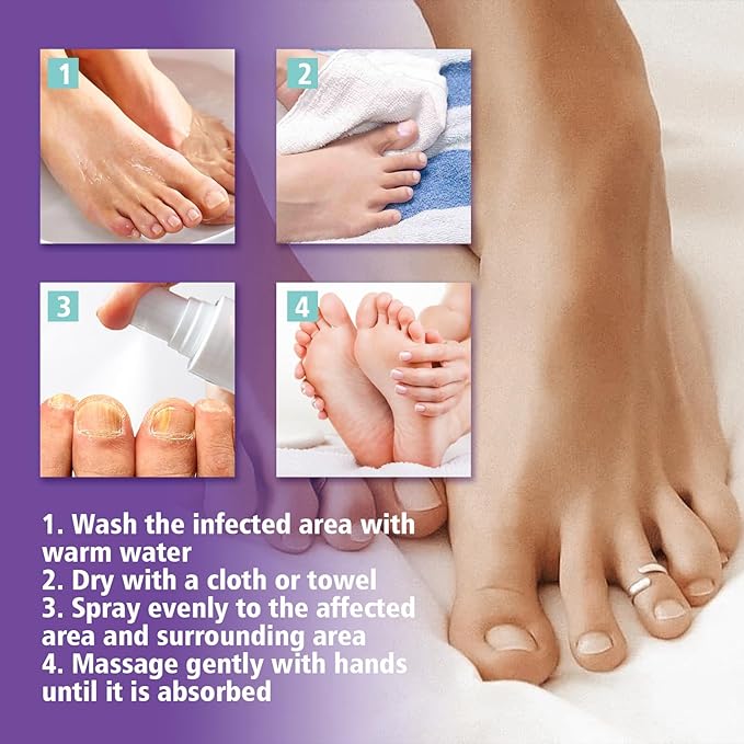 Nail Fungus Spray - Elvoque