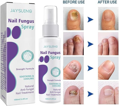Nail Fungus Spray - Elvoque