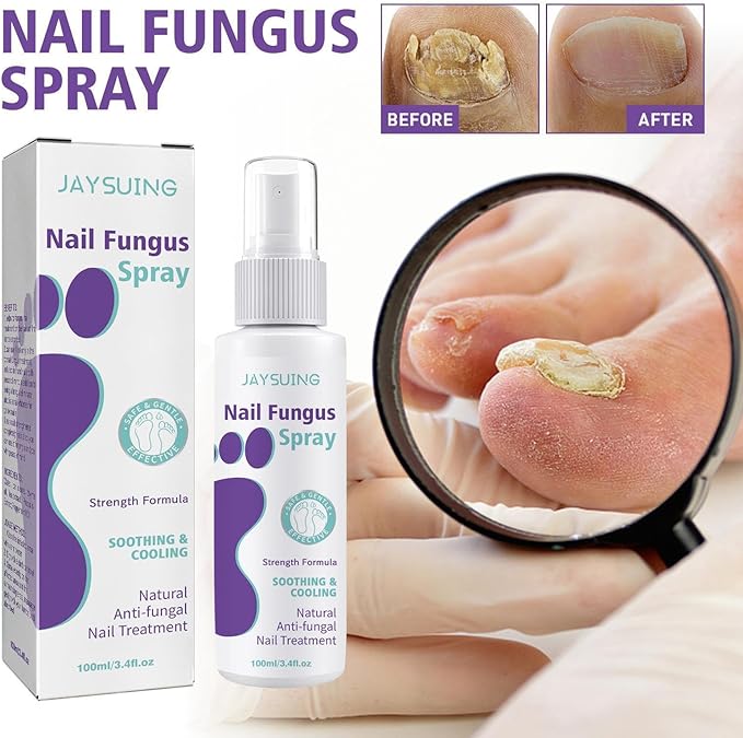 Nail Fungus Spray - Elvoque