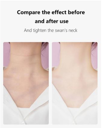 Anti Wrinkle Beauty Apparatus - Elvoque